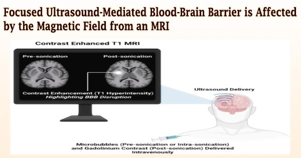 Focused Ultrasound-Mediated Blood-Brain Barrier is Affected by the Magnetic Field from an MRI