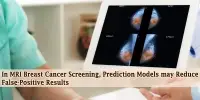 In MRI Breast Cancer Screening, Prediction Models may Reduce False-Positive Results