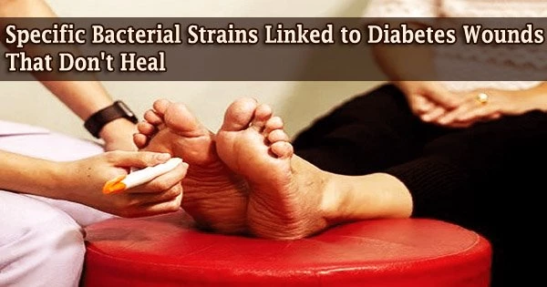 Specific Bacterial Strains Linked to Diabetes Wounds That Don’t Heal