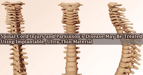 Spinal Cord Injury and Parkinson’s Disease May Be Treated Using Implantable, Ultra-Thin Material