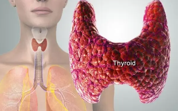 Thyroid-Disease-1