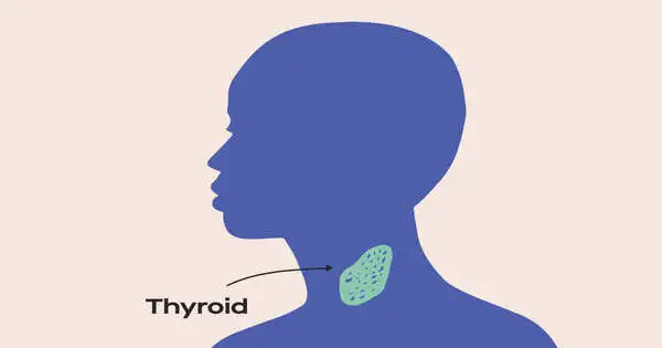 Thyroid Disease – a Medical Condition
