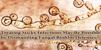 Treating Sticky Infections May Be Possible by Dismantling Fungal Biofilm Defenses