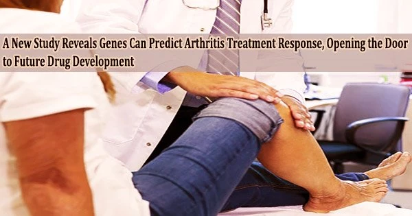 A New Study Reveals Genes Can Predict Arthritis Treatment Response, Opening the Door to Future Drug Development