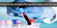 New Blood Test Helps in the Diagnosis of Rare Lung Disease, Pulmonary Arterial Hypertension