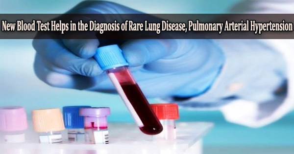 New Blood Test Helps in the Diagnosis of Rare Lung Disease, Pulmonary Arterial Hypertension