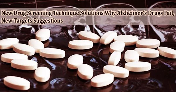 New Drug Screening Technique Solutions Why Alzheimer’s Drugs Fail, New Targets Suggestions