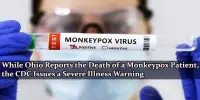 While Ohio Reports the Death of a Monkeypox Patient, the CDC Issues a Severe Illness Warning