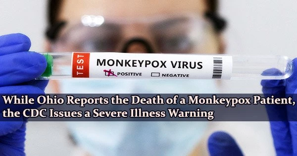 While Ohio Reports the Death of a Monkeypox Patient, the CDC Issues a Severe Illness Warning