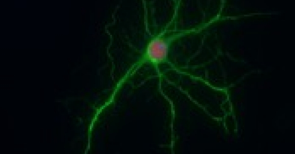A Fatal Neurological Disorder is linked to Cellular Housekeeping Process