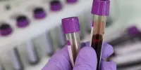 Alzheimer’s Disease Detection using Blood Samples