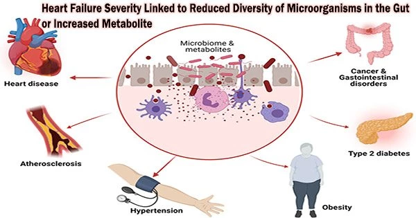 Heart Failure Severity Linked to Reduced Diversity of Microorganisms in the Gut or Increased Metabolite
