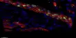 Observing the Onset of Skin Stem Cell Differentiation