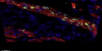 Observing the Onset of Skin Stem Cell Differentiation