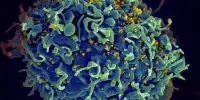 Study makes Significant Progress toward HIV Cure