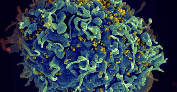 Study makes Significant Progress toward HIV Cure