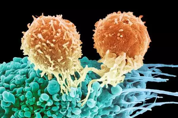 The-Cause-of-Prostate-Cancer-Metastasis-has-been-Identified-1