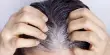 The Chemical that Regulates Hair Follicle Life and Death