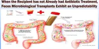 When the Recipient has not Already had Antibiotic Treatment, Feces Microbiological Transplants Exhibit an Unpredictability
