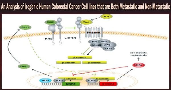 An Analysis of Isogenic Human Colorectal Cancer Cell lines that are Both Metastatic and Non-Metastatic