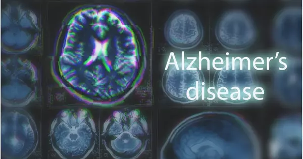 Discovered a New Target for Alzheimer’s Treatments