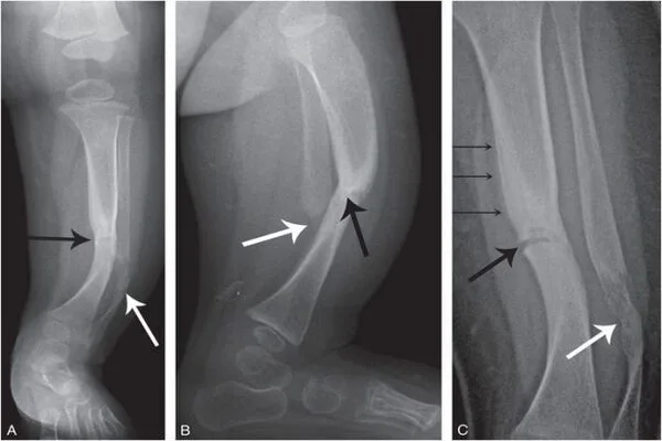 High-energy-X-rays-Damage-Bone-Collagen-1