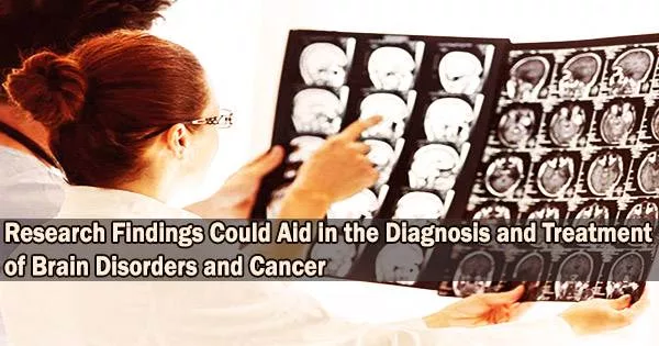 Research Findings Could Aid in the Diagnosis and Treatment of Brain Disorders and Cancer