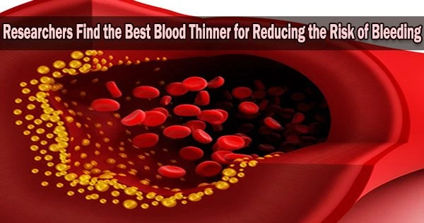 Researchers Find the Best Blood Thinner for Reducing the Risk of Bleeding