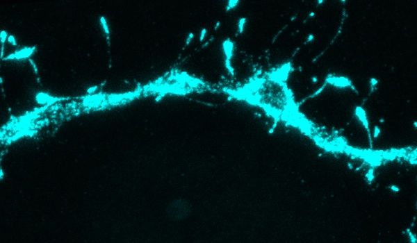 The-Adult-Brain-contains-a-Large-Number-of-Silent-Synapses-1