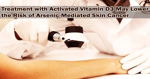 Treatment with Activated Vitamin D3 May Lower the Risk of Arsenic-Mediated Skin Cancer