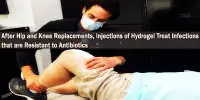 After Hip and Knee Replacements, Injections of Hydrogel Treat Infections that are Resistant to Antibiotics