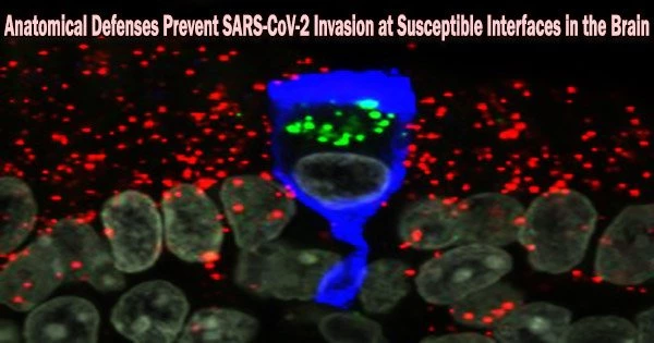 Anatomical Defenses Prevent SARS-CoV-2 Invasion at Susceptible Interfaces in the Brain