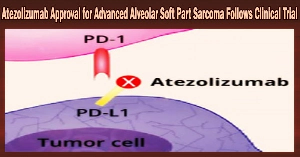 Atezolizumab Approval for Advanced Alveolar Soft Part Sarcoma Follows Clinical Trial