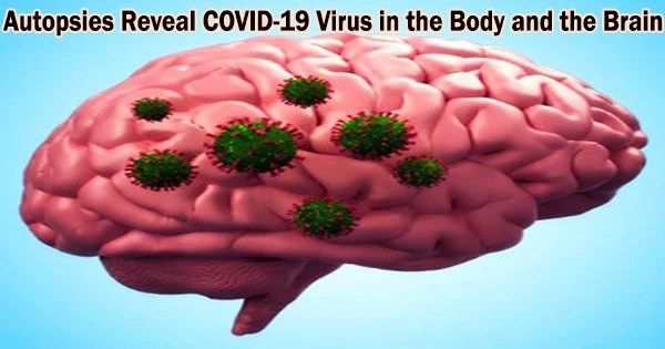 Autopsies Reveal COVID-19 Virus in the Body and the Brain