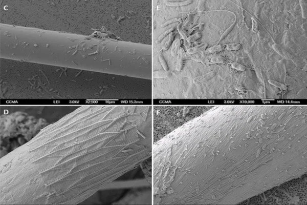 Bacteria-Thrive-in-the-Mediterranean-Seas-Microfibers-1