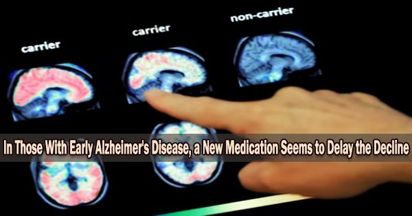 In Those With Early Alzheimer’s Disease, a New Medication Seems to Delay the Decline