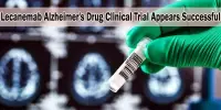 Lecanemab Alzheimer’s Drug Clinical Trial Appears Successful