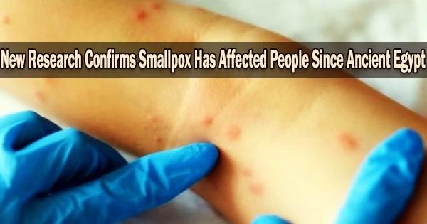 New Research Confirms Smallpox Has Affected People Since Ancient Egypt
