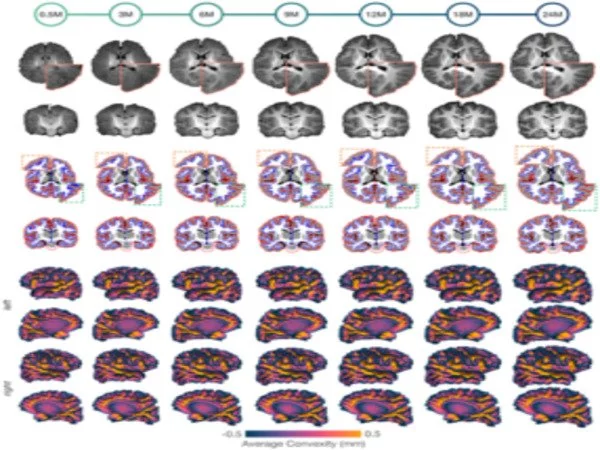 New collection of human brain atlases that chart postnatal development