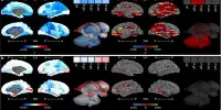 New Set of Postnatal Development-tracking Human Brain Atlases