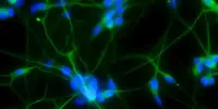 Second Type of Stem Cell was found in the Mouse Brain