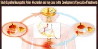 Study Explains Neuropathic Pain’s Mechanism and may Lead to the Development of Specialized Treatments