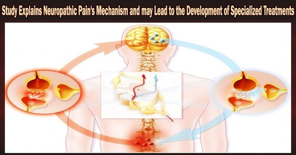 Study Explains Neuropathic Pain’s Mechanism and may Lead to the Development of Specialized Treatments
