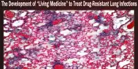 The Development of “Living Medicine” to Treat Drug-Resistant Lung Infections