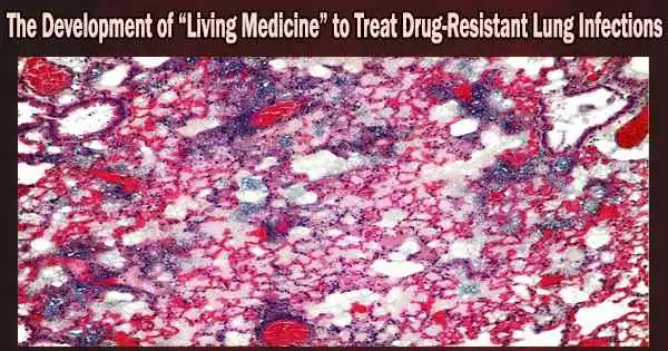 The Development of “Living Medicine” to Treat Drug-Resistant Lung Infections