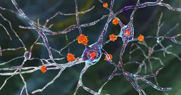 The Impact of Huntington’s Disease on Various Neurons