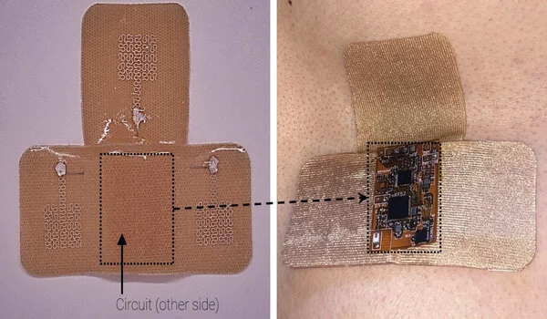 Screen-printing method can make wearable electronics less expensive