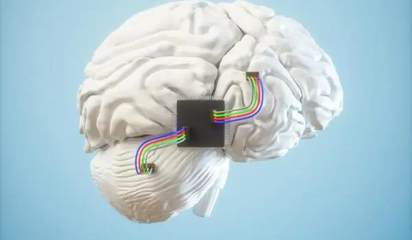 A neuro-chip to manage brain disorders
