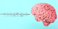A Neuro-chip for the Treatment of Brain Disorders