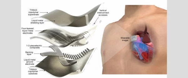 Wearable sensor uses ultrasound to provide cardiac imaging on the go